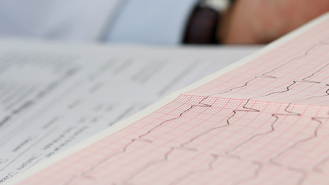 EuGH-Erhoehter-Kuendigungsschutz_Headerbild-gross © megaflopp-–-stock.adobe.com